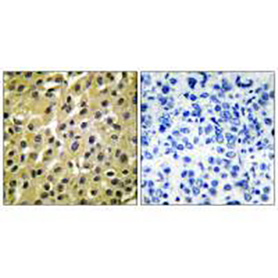 MDM2 Rabbit Polyclonal Antibody | 兔多抗 | EnkiLife恩玑生命