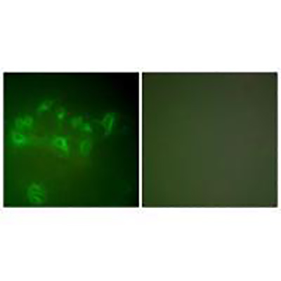 MDM2 Rabbit Polyclonal Antibody | 兔多抗 | EnkiLife恩玑生命