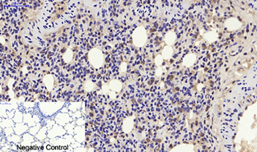 p21 Rabbit Polyclonal Antibody | 兔多抗 | EnkiLife恩玑生命
