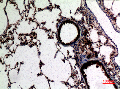 CD62L Rabbit Polyclonal Antibody | 兔多抗 | EnkiLife恩玑生命