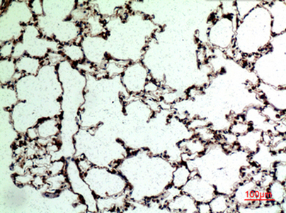 CD62L Rabbit Polyclonal Antibody | 兔多抗 | EnkiLife恩玑生命
