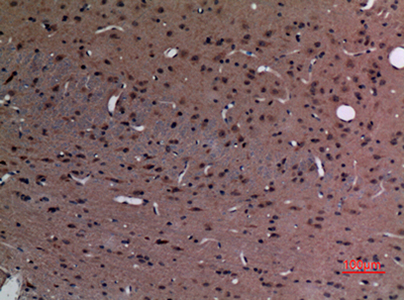 Stathmin 2 Rabbit Polyclonal Antibody | 兔多抗 | EnkiLife恩玑生命