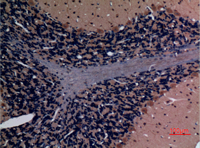 Stathmin 2 Rabbit Polyclonal Antibody | 兔多抗 | EnkiLife恩玑生命