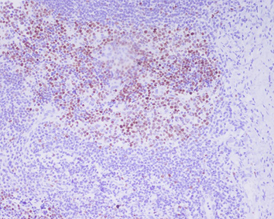 Phospho-Histone H3 (Thr3) Rabbit Polyclonal Antibody | 兔多抗 | EnkiLife恩玑生命