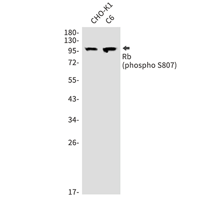 Phospho-Rb (Ser807) Rabbit Polyclonal Antibody | 兔多抗 | EnkiLife恩玑生命
