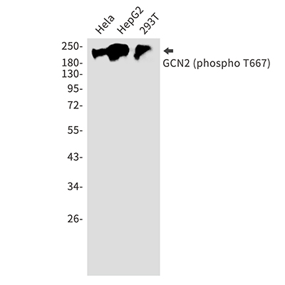 Phospho-GCN2 (Thr667) Rabbit Polyclonal Antibody | 兔多抗 | EnkiLife恩玑生命