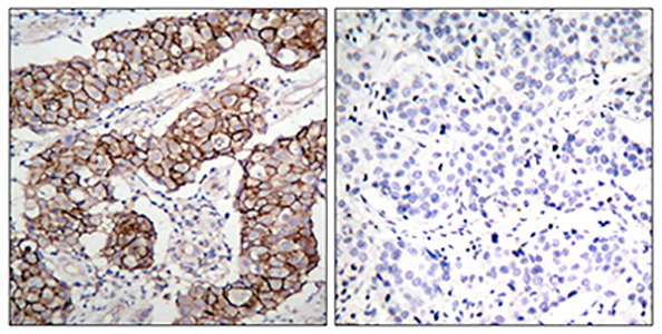 Phospho-EGFR (Tyr1092) Rabbit Polyclonal Antibody | 兔多抗 | EnkiLife恩玑生命