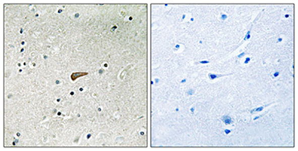 Phospho-FRS2 (Tyr436) Rabbit Polyclonal Antibody | 兔多抗 | EnkiLife恩玑生命