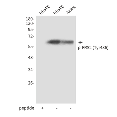 Phospho-FRS2 (Tyr436) Rabbit Polyclonal Antibody | 兔多抗 | EnkiLife恩玑生命
