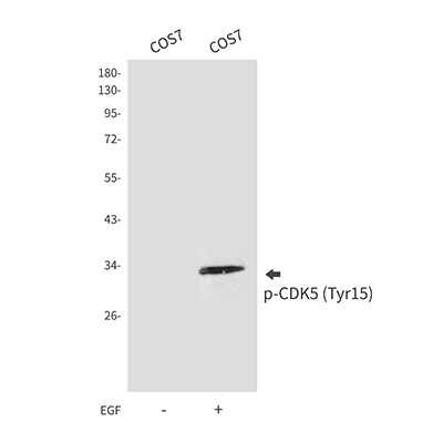 Phospho-CDK5 (Tyr15) Rabbit Polyclonal Antibody | 兔多抗 | EnkiLife恩玑生命