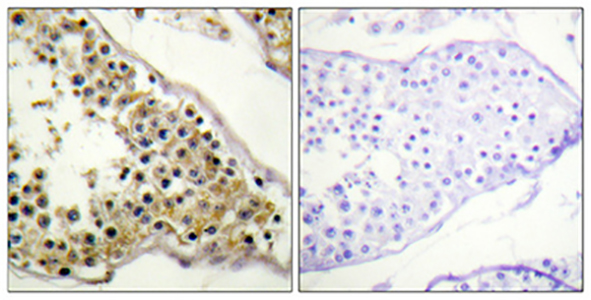 Phospho-ITK (Tyr512) Rabbit Polyclonal Antibody | 兔多抗 | EnkiLife恩玑生命