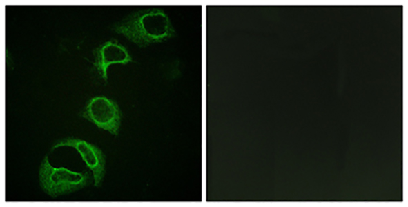 Phospho-ALK (Tyr1604) Rabbit Polyclonal Antibody | 兔多抗 | EnkiLife恩玑生命