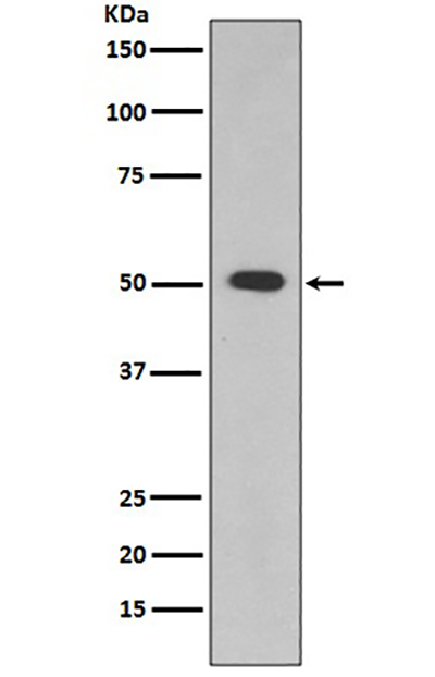 ALDH1A1 Rabbit Polyclonal Antibody | 兔多抗 | EnkiLife恩玑生命