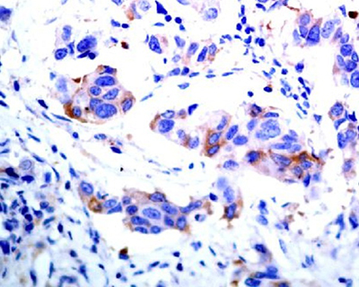 ASK1 Rabbit Polyclonal Antibody | 兔多抗 | EnkiLife恩玑生命