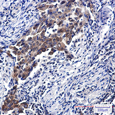 NSE Rabbit Polyclonal Antibody | 兔多抗 | EnkiLife恩玑生命