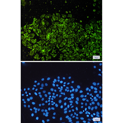 NSE Rabbit Polyclonal Antibody | 兔多抗 | EnkiLife恩玑生命