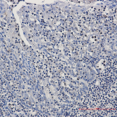 GRB2 Rabbit Polyclonal Antibody | 兔多抗 | EnkiLife恩玑生命