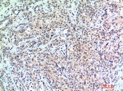 p300 Rabbit Polyclonal Antibody | 兔多抗 | EnkiLife恩玑生命