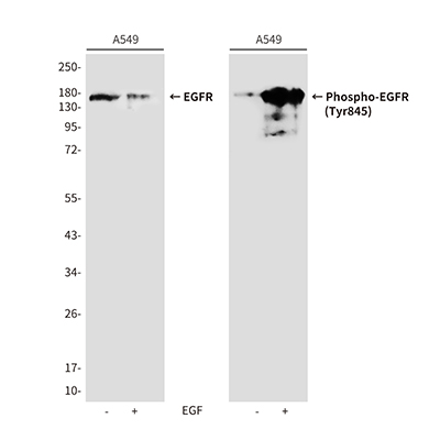Phospho-EGFR (Tyr845) Rabbit Polyclonal Antibody | 兔多抗 | EnkiLife恩玑生命