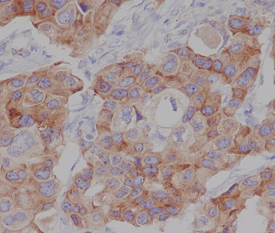 Phospho-mTOR (Ser2448) Rabbit Polyclonal Antibody | 兔多抗 | EnkiLife恩玑生命