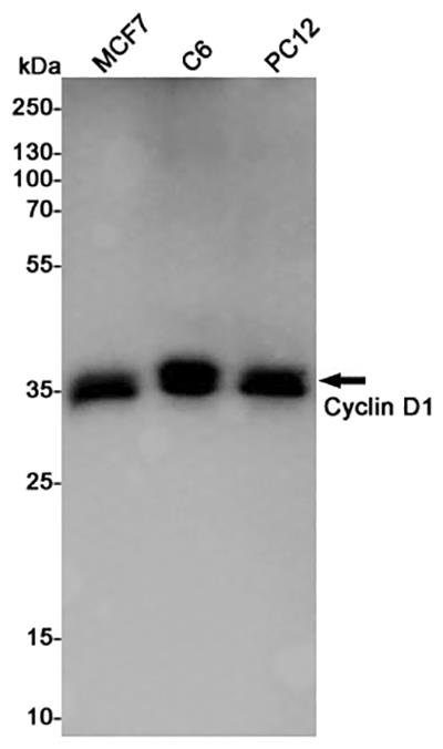 Cyclin D1 Rabbit Polyclonal Antibody | 兔多抗 | EnkiLife恩玑生命