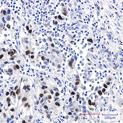 Cyclin D1 Rabbit Polyclonal Antibody | 兔多抗 | EnkiLife恩玑生命