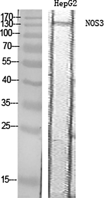 eNOS Rabbit Polyclonal Antibody | 兔多抗 | EnkiLife恩玑生命