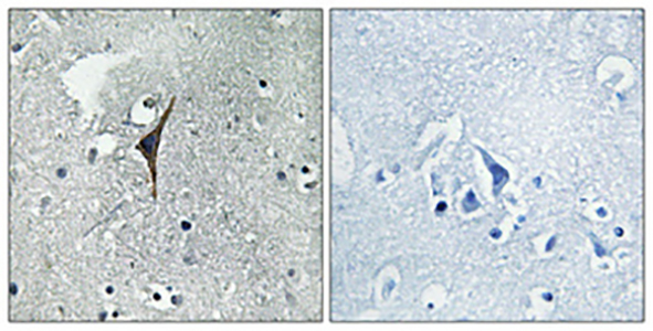 eNOS Rabbit Polyclonal Antibody | 兔多抗 | EnkiLife恩玑生命