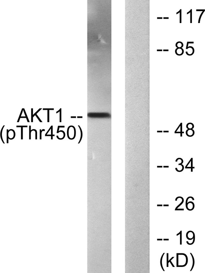 Akt1 (phospho Thr450) Rabbit Polyclonal Antibody | 兔多抗 | EnkiLife恩玑生命