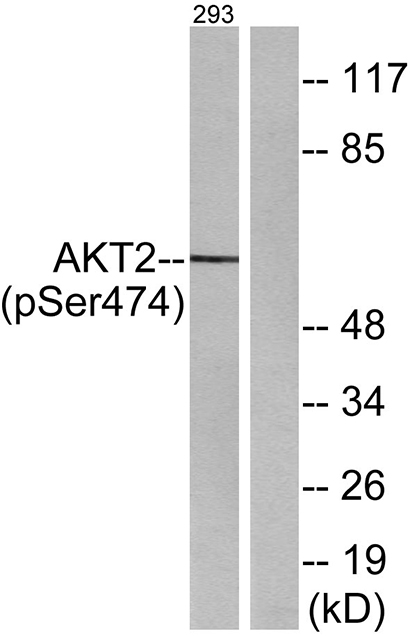 Akt2 (phospho Ser474) Rabbit Polyclonal Antibody | 兔多抗 | EnkiLife恩玑生命