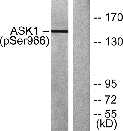 ASK 1 (phospho Ser966) Rabbit Polyclonal Antibody | 兔多抗 | EnkiLife恩玑生命