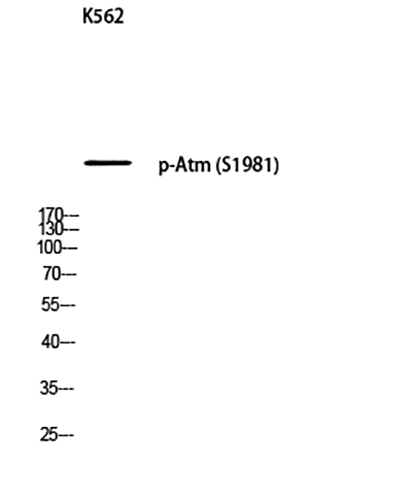 Atm (phospho Ser1981) Rabbit Polyclonal Antibody | 兔多抗 | EnkiLife恩玑生命