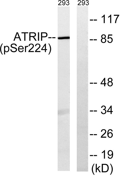 ATRIP (phospho Ser224) Rabbit Polyclonal Antibody | 兔多抗 | EnkiLife恩玑生命