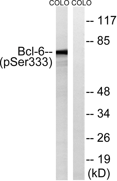 Bcl-6 (phospho Ser333) Rabbit Polyclonal Antibody | 兔多抗 | EnkiLife恩玑生命