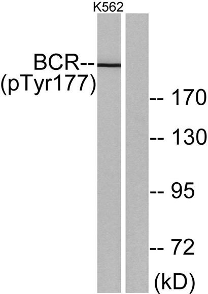 Bcr (phospho Tyr177) Rabbit Polyclonal Antibody | 兔多抗 | EnkiLife恩玑生命