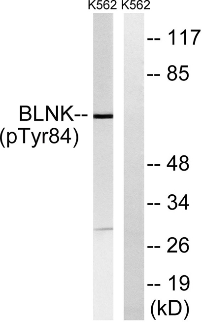 BLNK (phospho Tyr84) Rabbit Polyclonal Antibody | 兔多抗 | EnkiLife恩玑生命