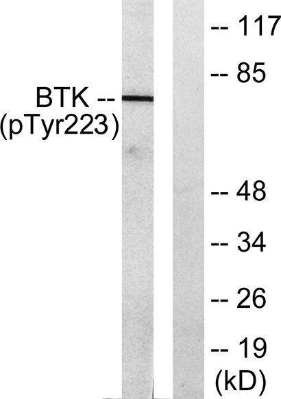 Btk (phospho Tyr223) Rabbit Polyclonal Antibody | 兔多抗 | EnkiLife恩玑生命