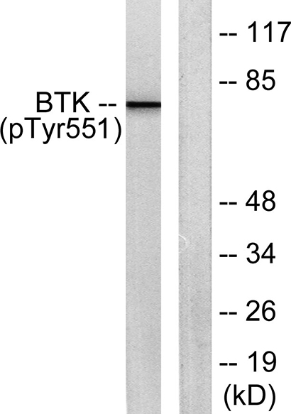 Btk (phospho Tyr551) Rabbit Polyclonal Antibody | 兔多抗 | EnkiLife恩玑生命