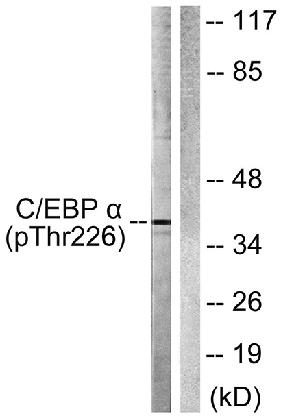 C/EBP α (phospho Thr226) Rabbit Polyclonal Antibody | 兔多抗 | EnkiLife恩玑生命