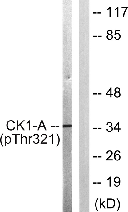 Casein Kinase Iα (phospho Tyr321) Rabbit Polyclonal Antibody | 兔多抗 | EnkiLife恩玑生命