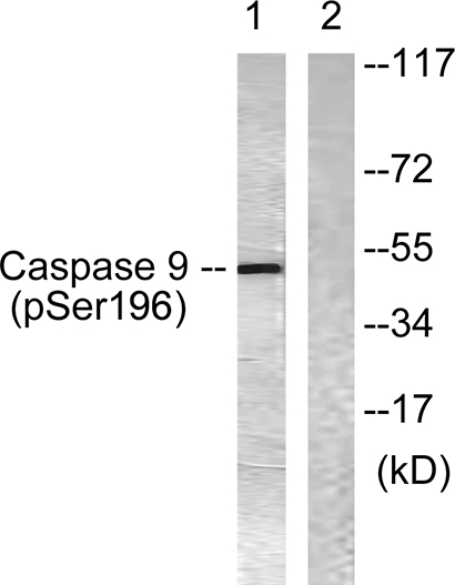 Caspase-9 (phospho Ser196) Rabbit Polyclonal Antibody | 兔多抗 | EnkiLife恩玑生命