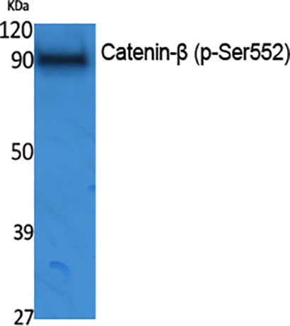 Catenin-β (phospho Ser552) Rabbit Polyclonal Antibody | 兔多抗 | EnkiLife恩玑生命