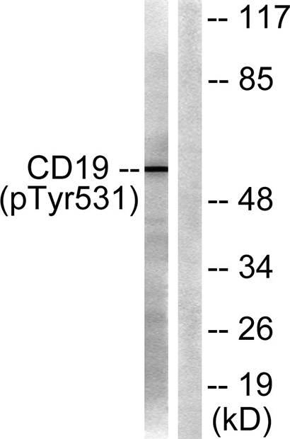 CD19 (phospho Tyr531) Rabbit Polyclonal Antibody | 兔多抗 | EnkiLife恩玑生命