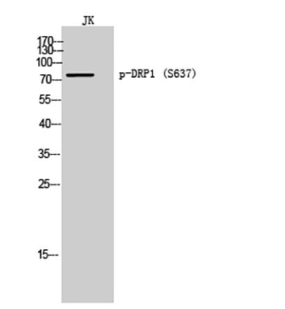 DRP1 (phospho Ser637) Rabbit Polyclonal Antibody | 兔多抗 | EnkiLife恩玑生命