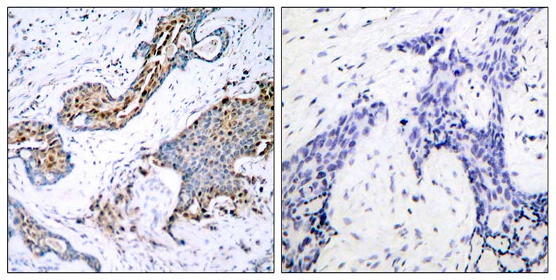 ERα (phospho Ser118) Rabbit Polyclonal Antibody | 兔多抗 | EnkiLife恩玑生命