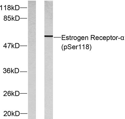 ERα (phospho Ser118) Rabbit Polyclonal Antibody | 兔多抗 | EnkiLife恩玑生命