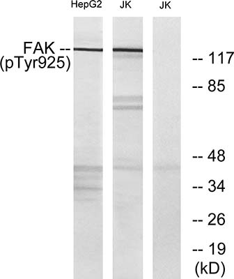 FAK (phospho Tyr925) Rabbit Polyclonal Antibody | 兔多抗 | EnkiLife恩玑生命