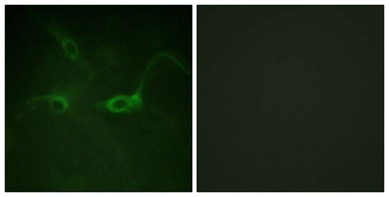 Flg (phospho Tyr654) Rabbit Polyclonal Antibody | 兔多抗 | EnkiLife恩玑生命