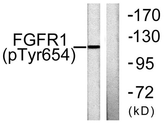 Flg (phospho Tyr654) Rabbit Polyclonal Antibody | 兔多抗 | EnkiLife恩玑生命