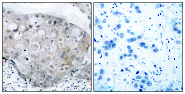 Flk-1 (phospho Tyr951) Rabbit Polyclonal Antibody | 兔多抗 | EnkiLife恩玑生命